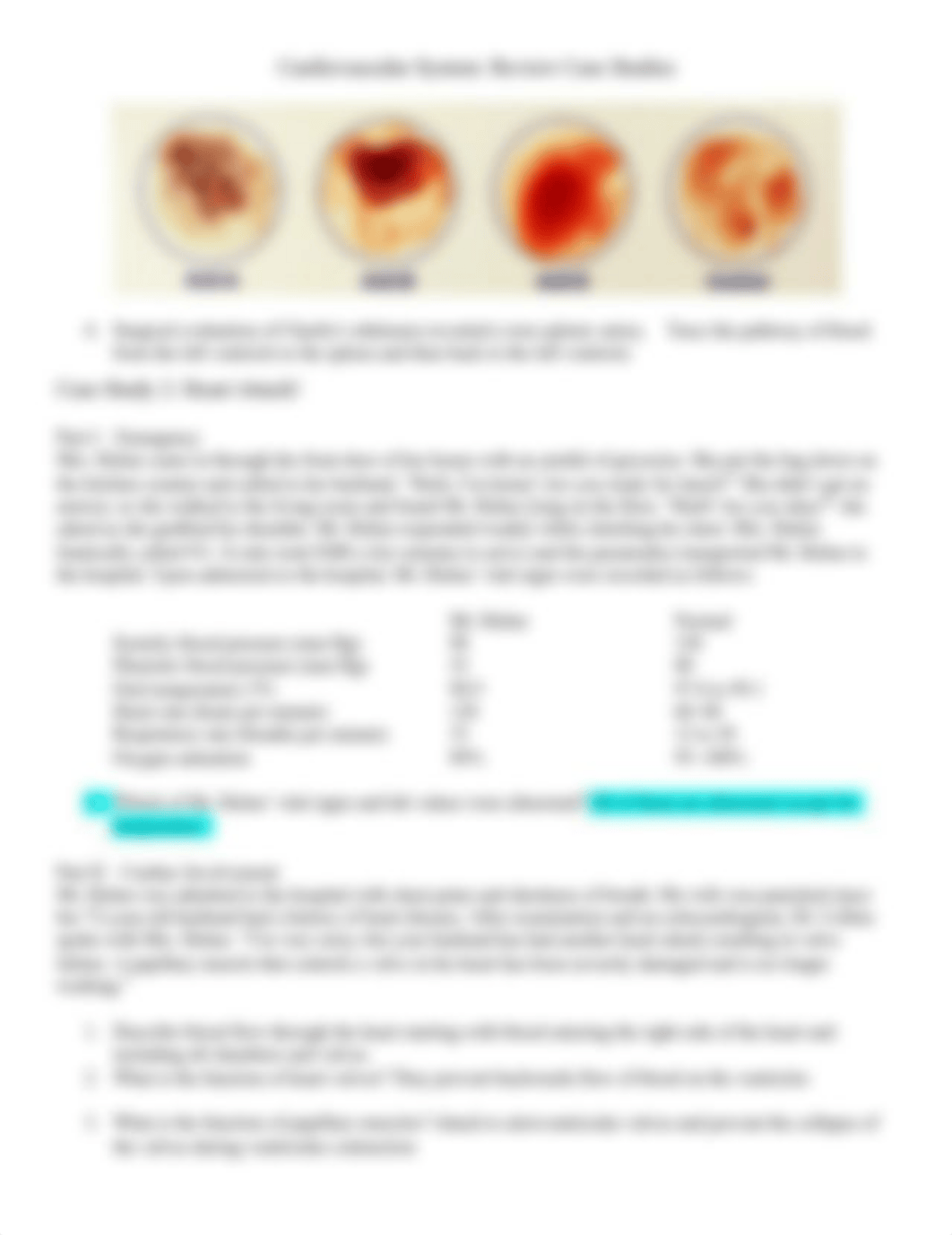 Heart Review Case Study.docx_dnxie1728pn_page2