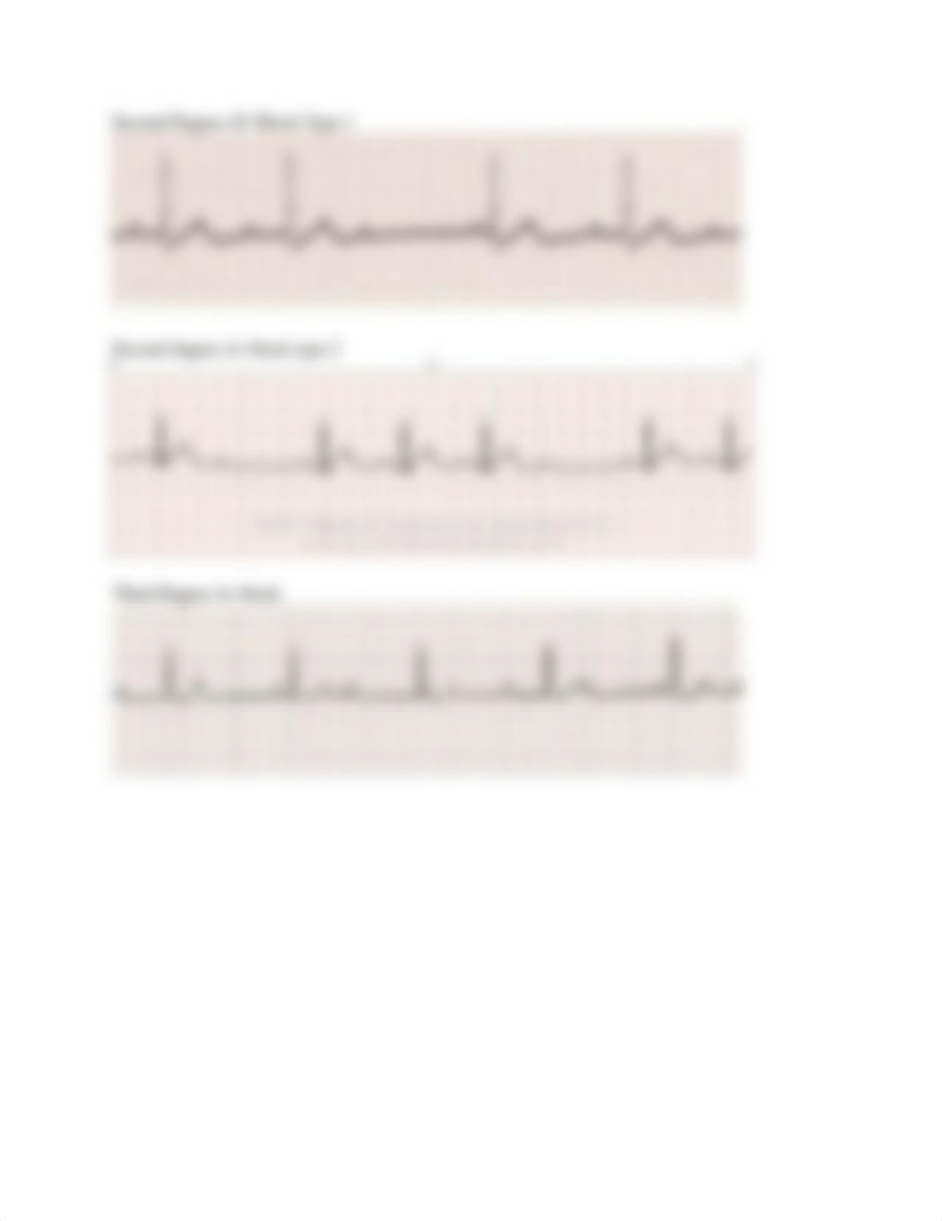 Ventricular Dysrhytmias .docx_dnxqghdwwuj_page3