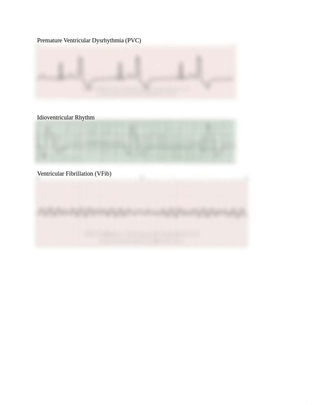 Ventricular Dysrhytmias .docx_dnxqghdwwuj_page1