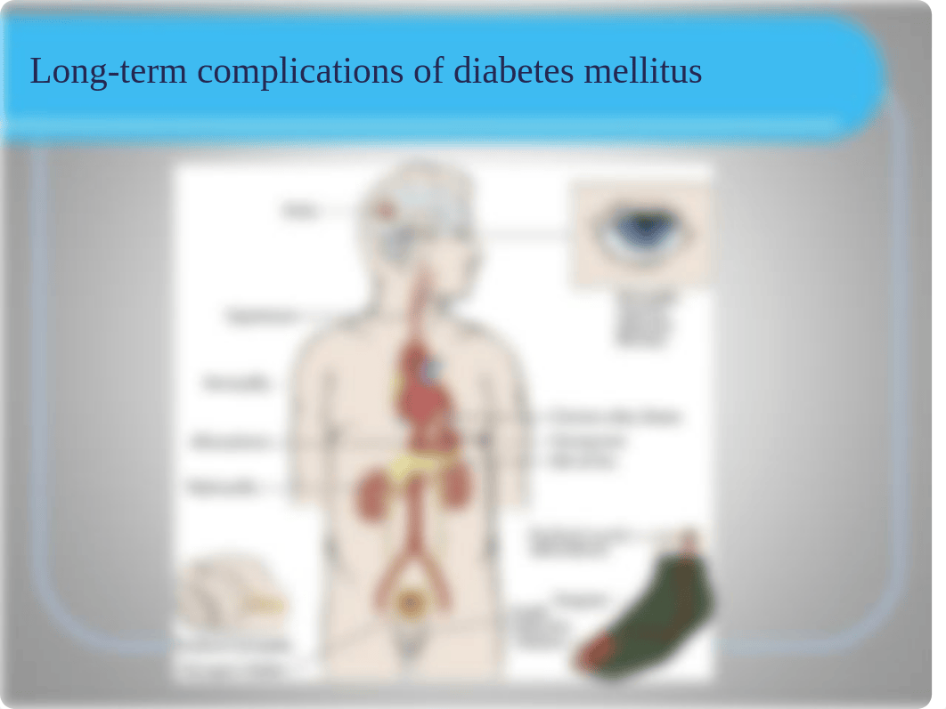 Long Term Complications of diabetes Notes.ppt_dnyt8fnquti_page3