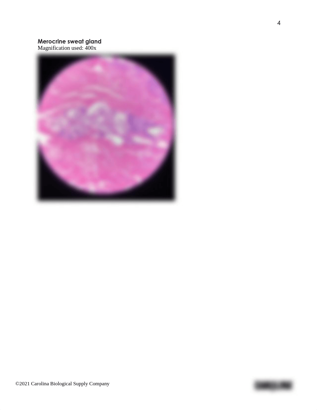 K Harvey BIO201 Introduction to Histology_The Skin_Answer sheet.pdf_dnztw8kmul8_page4