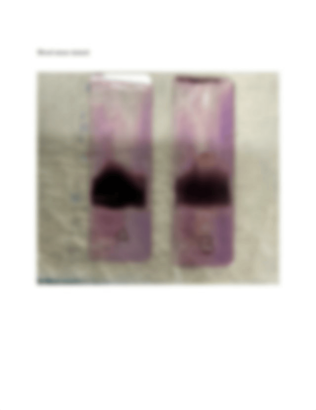 Blood Smear.docx_doaurx3kkzw_page3