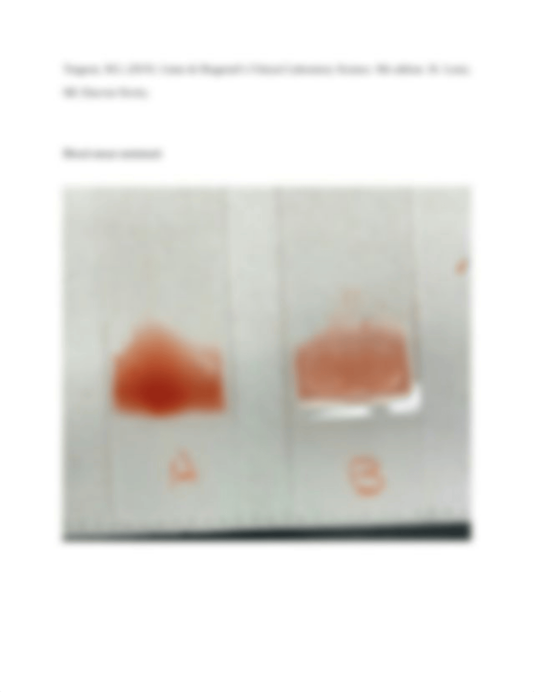 Blood Smear.docx_doaurx3kkzw_page2