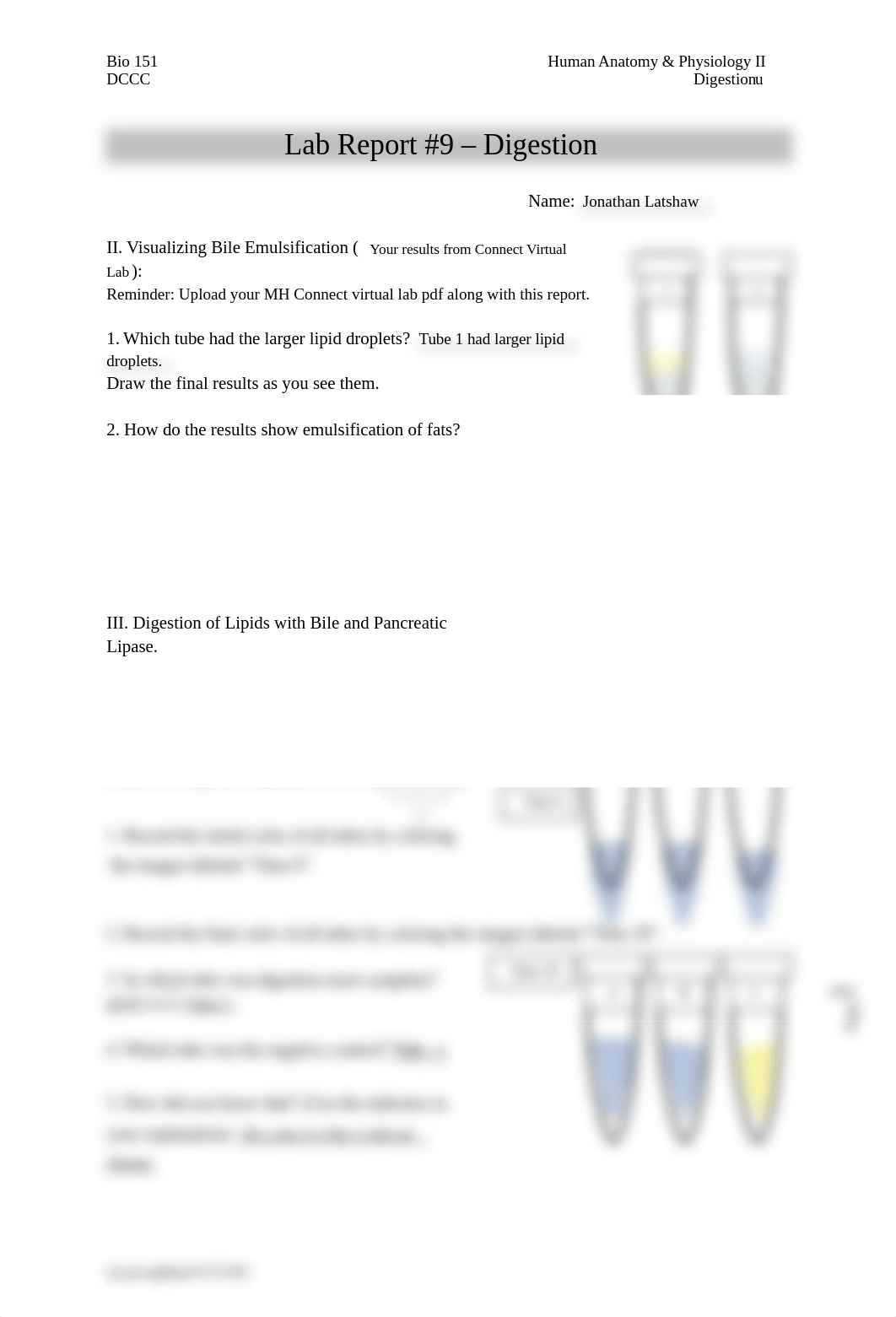 Latshaw_BIO 151 Lab #9 Digestion ff.docx_dobv1z0duje_page1