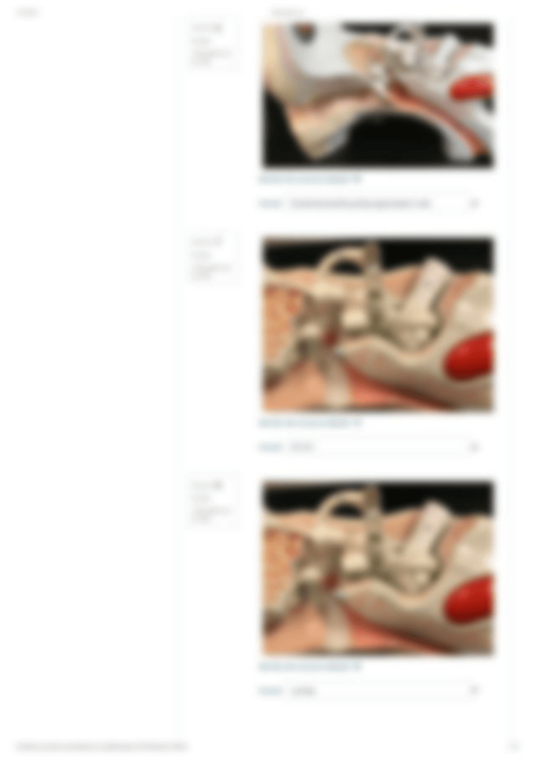 Neuro quiz_ ear.pdf_dodwtn6ddu2_page5