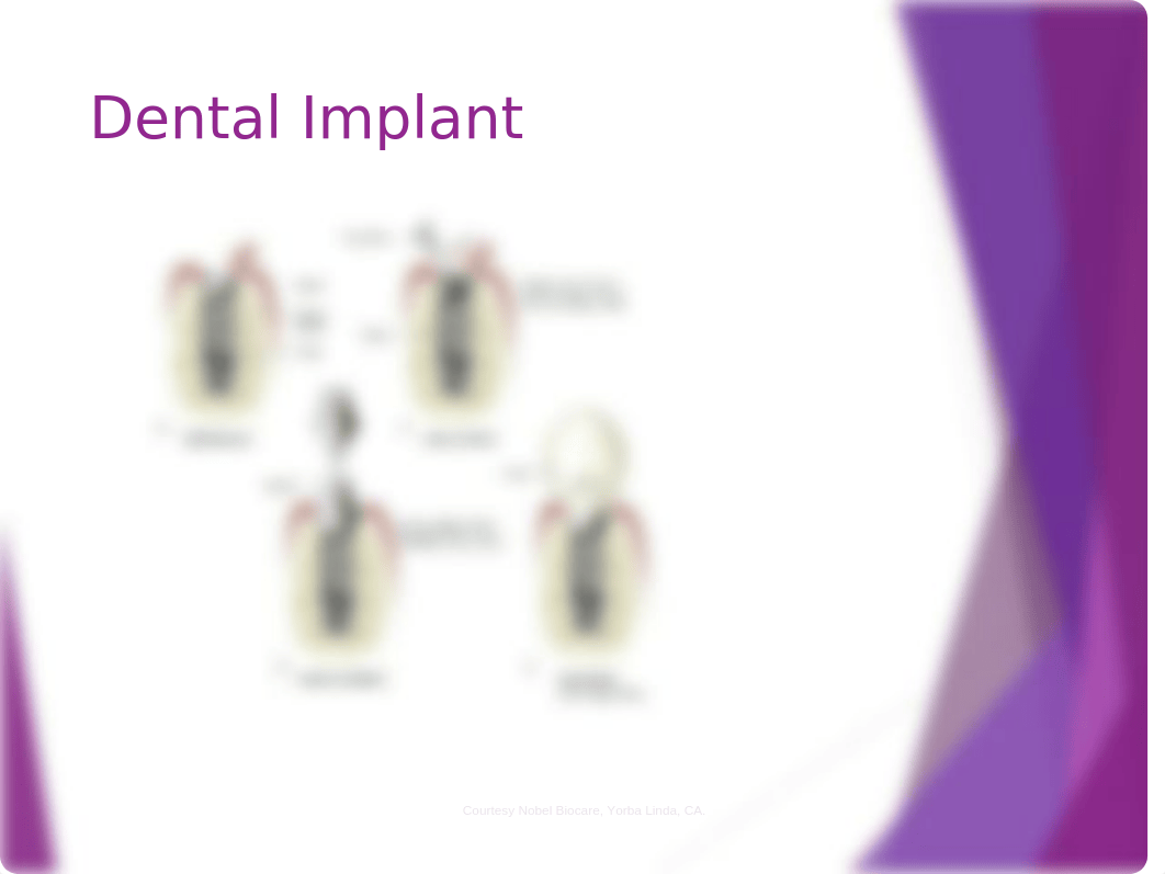 Dental Implants Chapter 53.pptx_doem0rdfo2s_page4