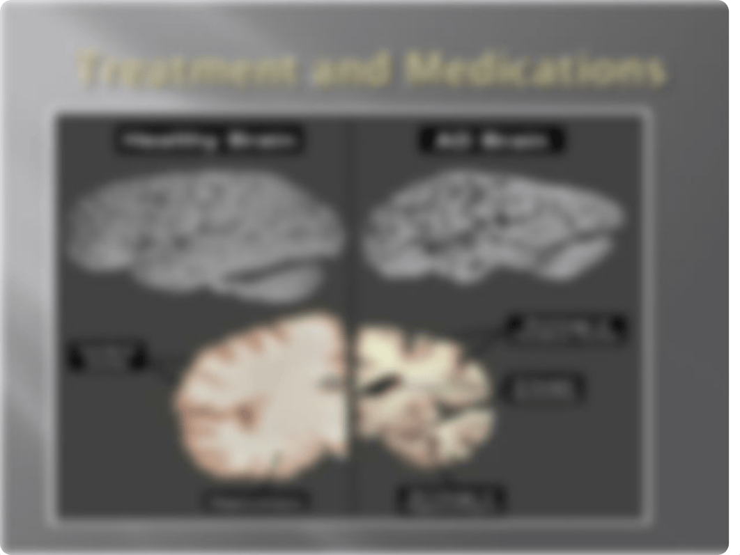 Alzheimer's.ppt_dolm9yrzcsr_page2