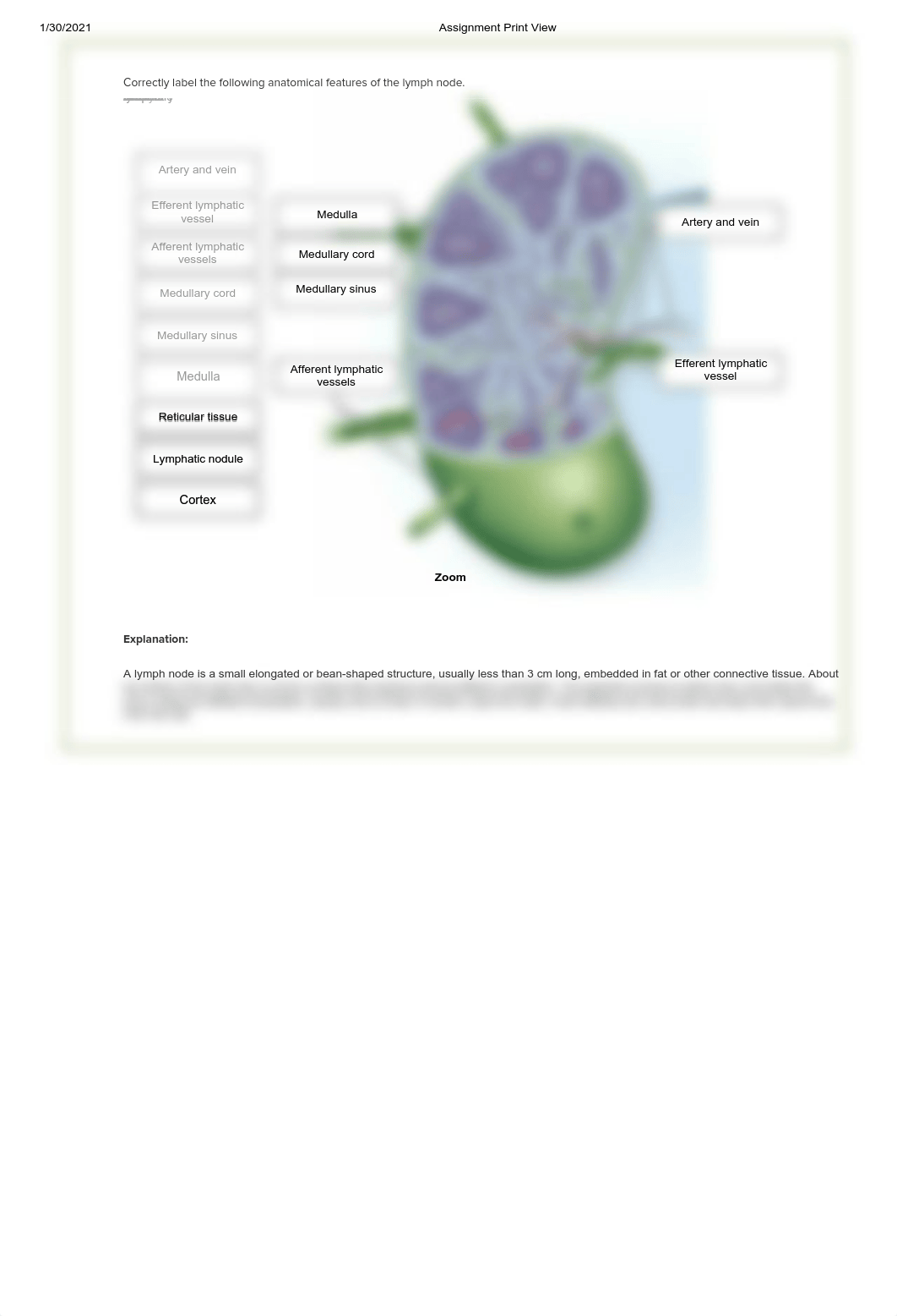 AP II Lab_MA279 BSC2347L_Section 13_Module 4_Pre-Lab Assignment_1302021.pdf_dolwn47jl4b_page4