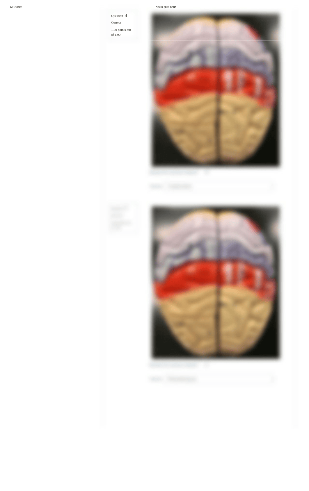 Neuro quiz_ brain.pdf_doqu59emj2d_page3