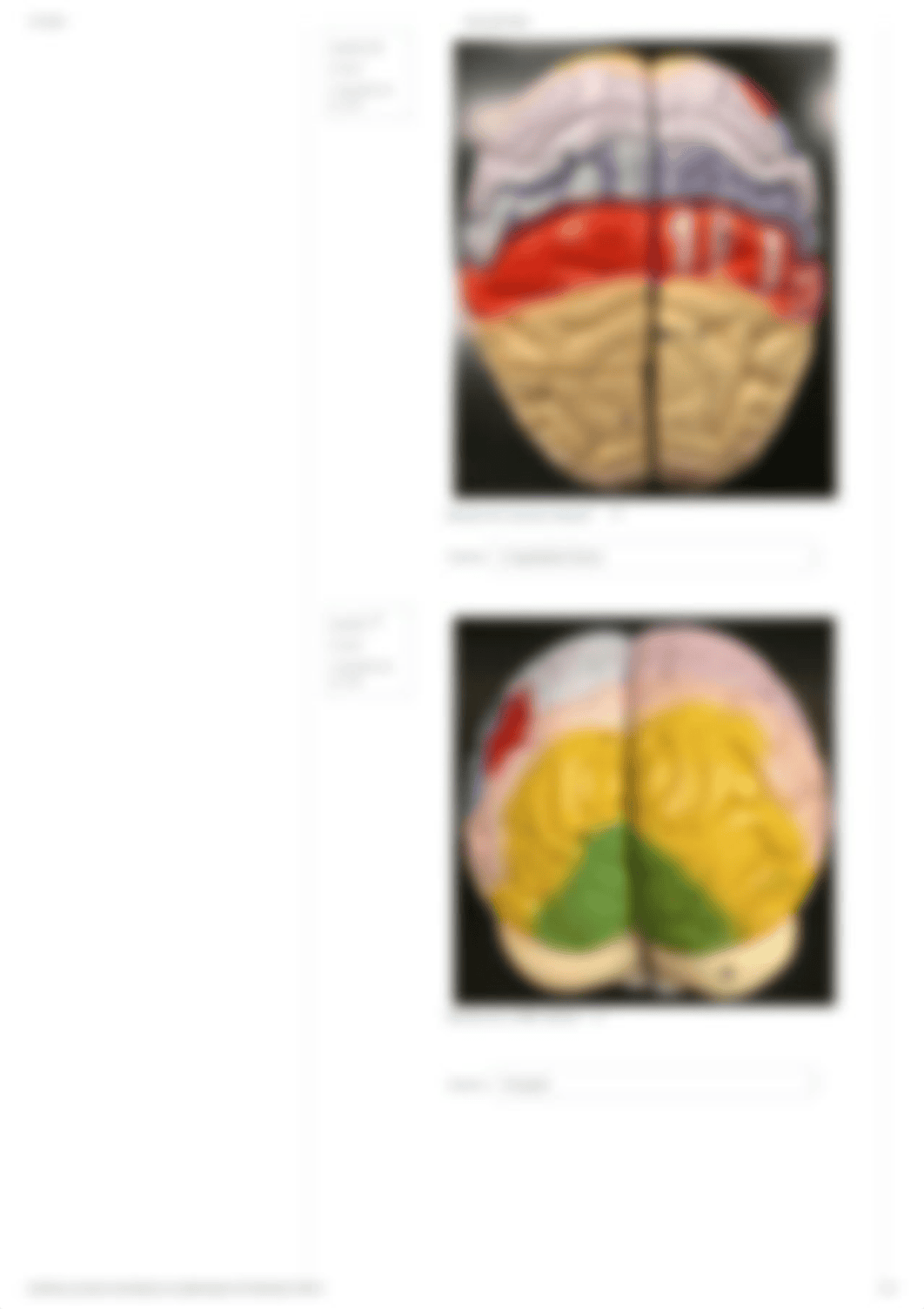 Neuro quiz_ brain.pdf_doqu59emj2d_page4