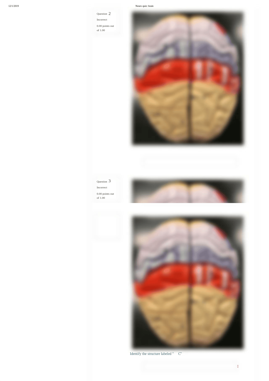 Neuro quiz_ brain.pdf_doqu59emj2d_page2