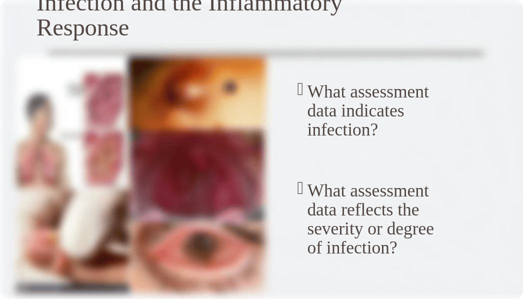 Fundamentals NR 224 Infection Prevention and Control Student.pptx_dotdun07kc2_page4