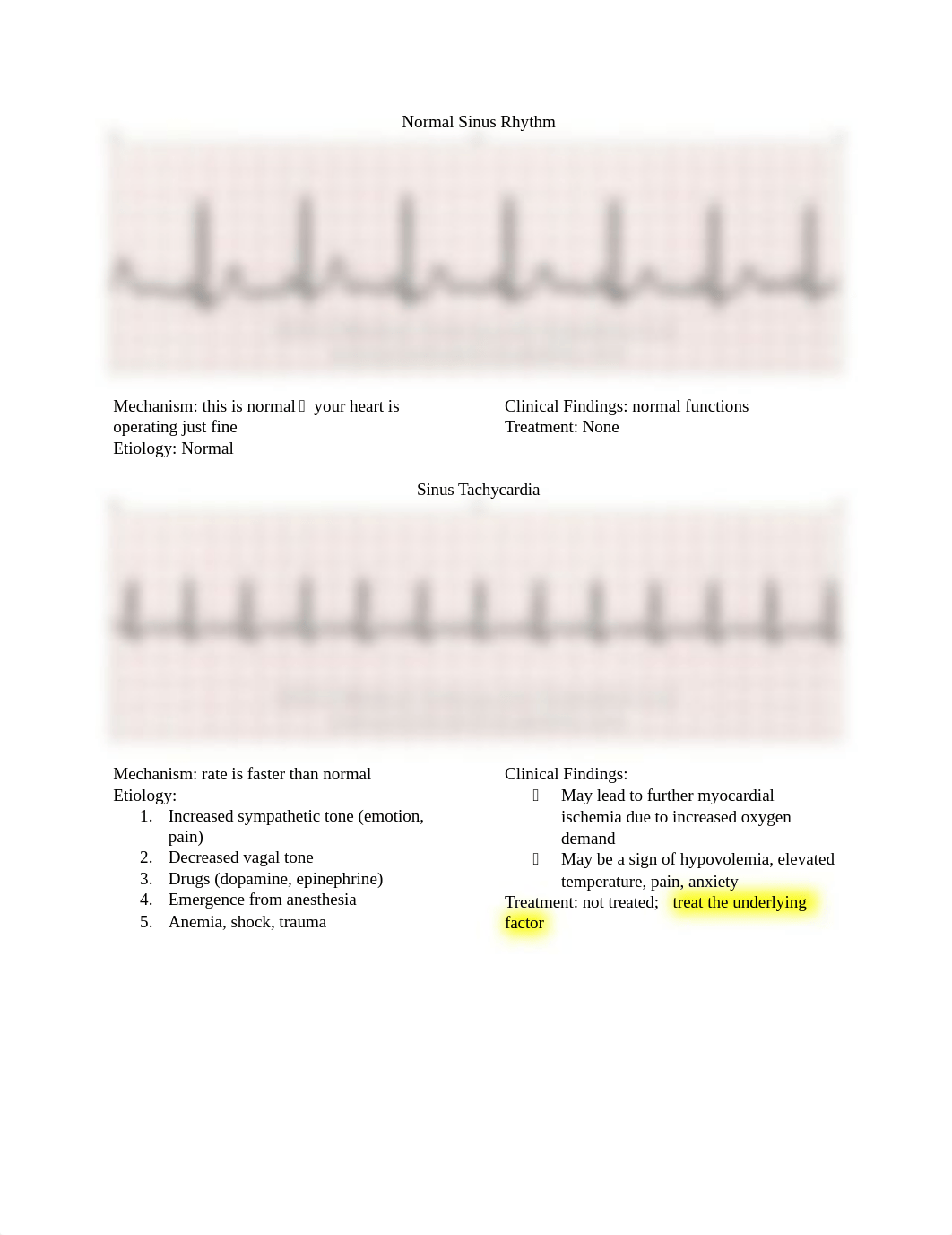 EKG Rhythms.docx_dowbba2ym5a_page1