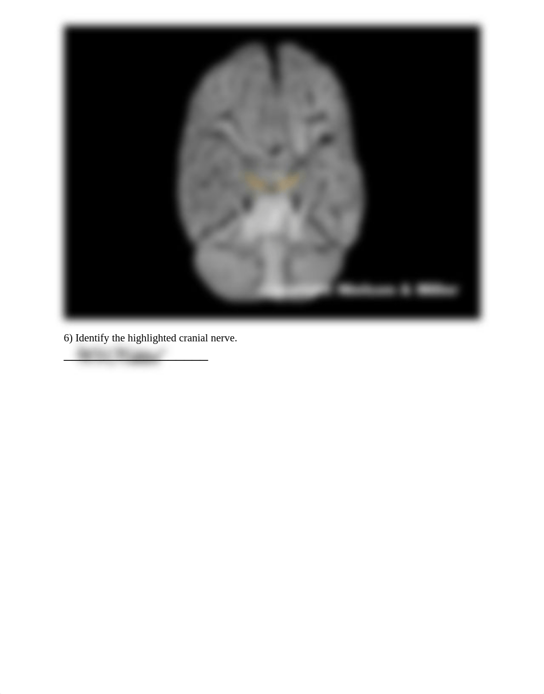 31_cranial_nerves_anatomy_and_physiology_Worksheet.pdf_doyqvj9b5hn_page5