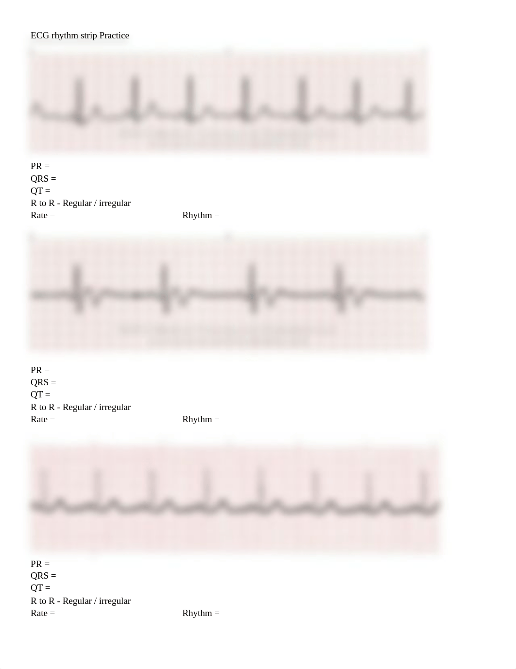 ECG rhythm strip interpretation-2.docx_dp2achlkzj7_page1