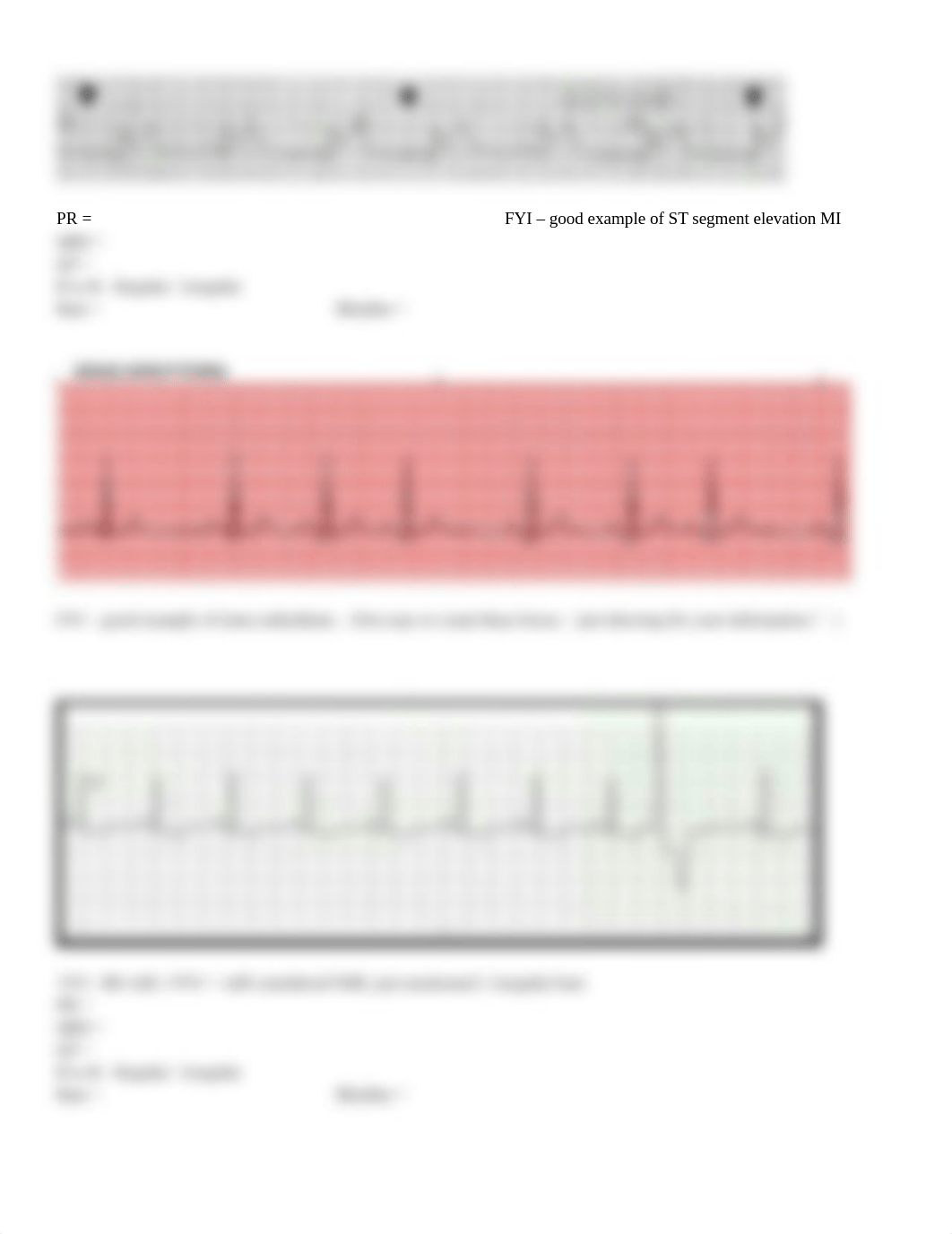 ECG rhythm strip interpretation-2.docx_dp2achlkzj7_page3