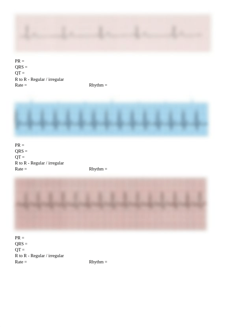 ECG rhythm strip interpretation-2.docx_dp2achlkzj7_page2