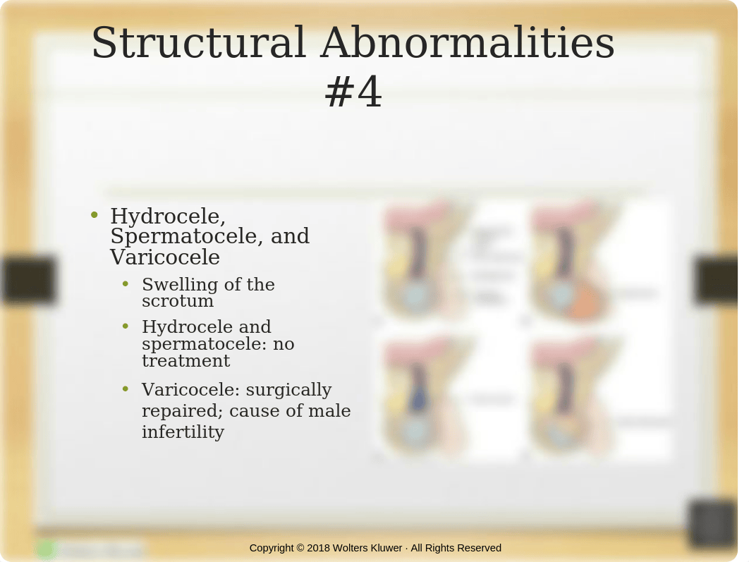 Reproductive PPT_Chapter_55(1).pptx_dpeqcjvhp5h_page5