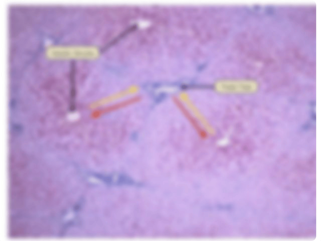 Lecture 49 -Liver_dphkcs05l26_page5