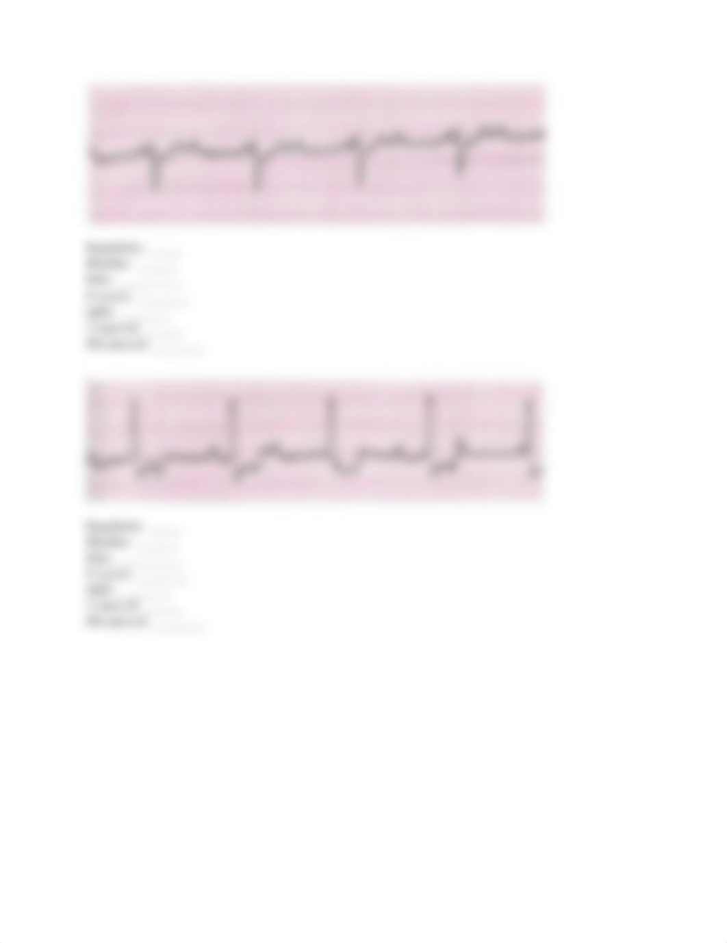 ekg assignment .docx_dpjs6r229er_page5