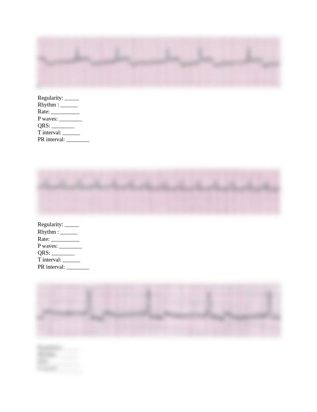 ekg assignment .docx_dpjs6r229er_page3