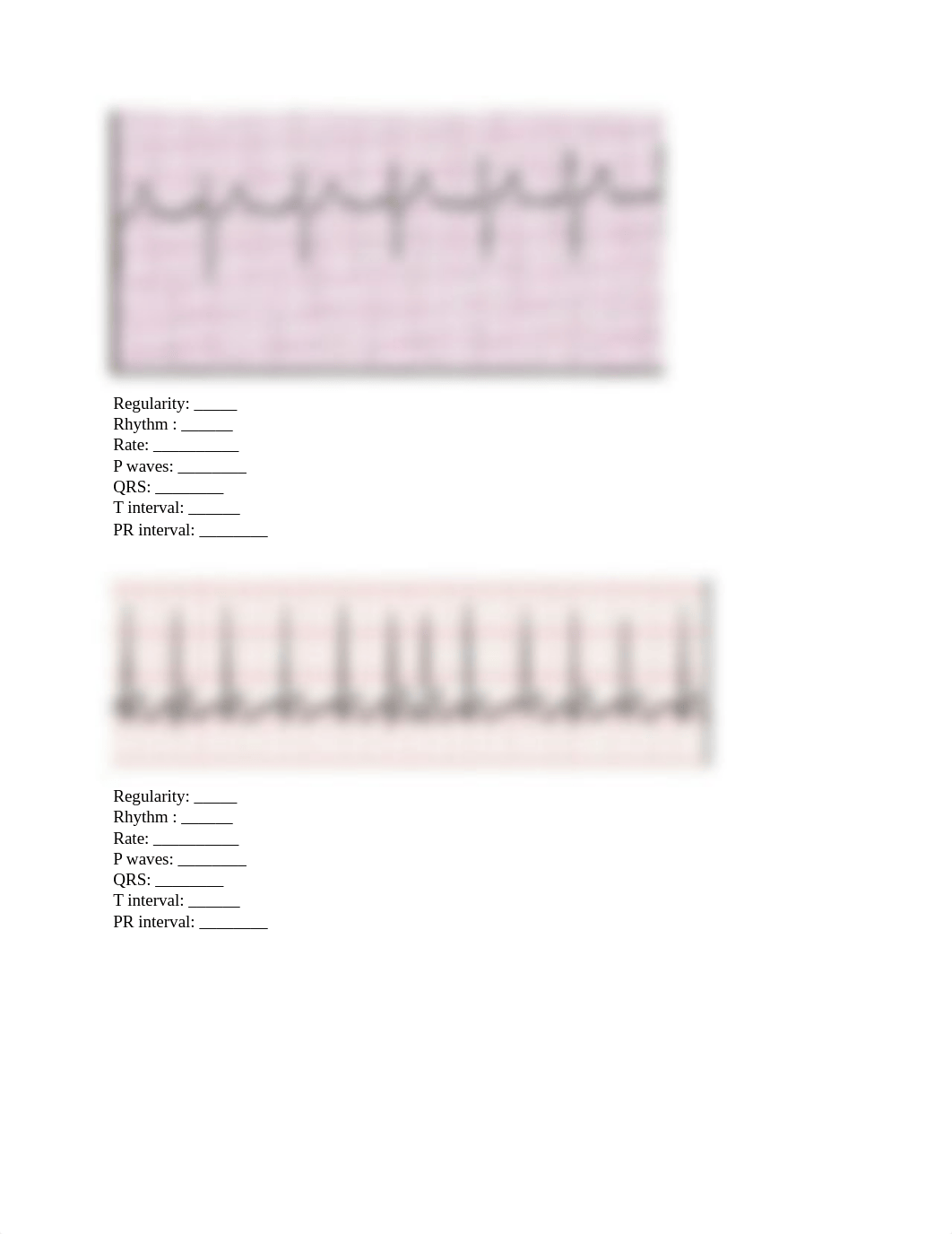 ekg assignment .docx_dpjs6r229er_page2