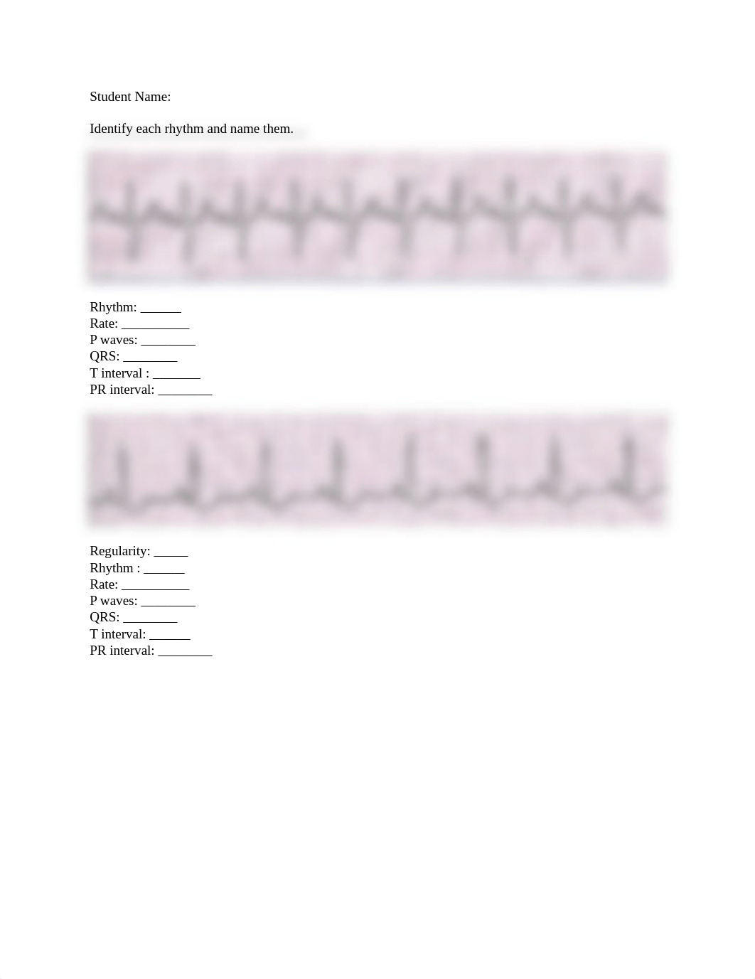 ekg assignment .docx_dpjs6r229er_page1