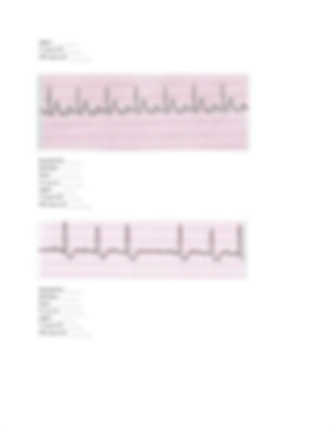 ekg assignment .docx_dpjs6r229er_page4