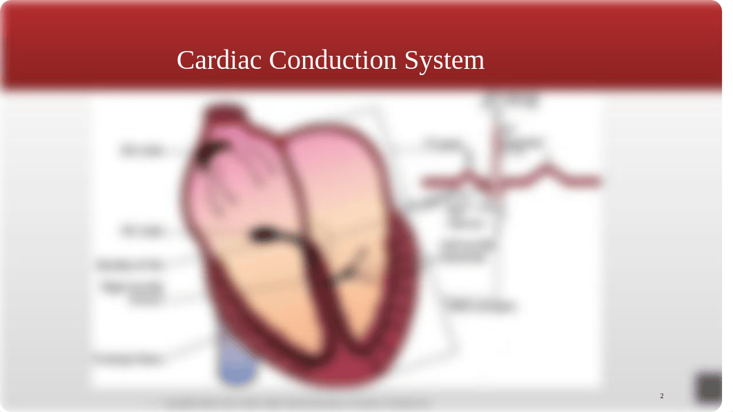 EKG Interpretation PP with voice over.pptx_dpwkgsyyt0i_page2