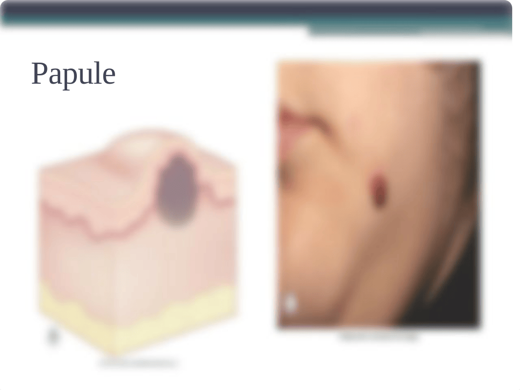 Common Dermatological Presentations_Student.pptx_dqc1crkd4im_page5