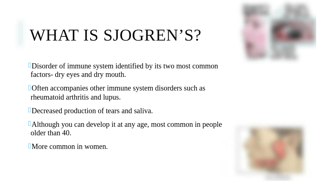 Sjogren's syndrome_dqc6wav8rxb_page2