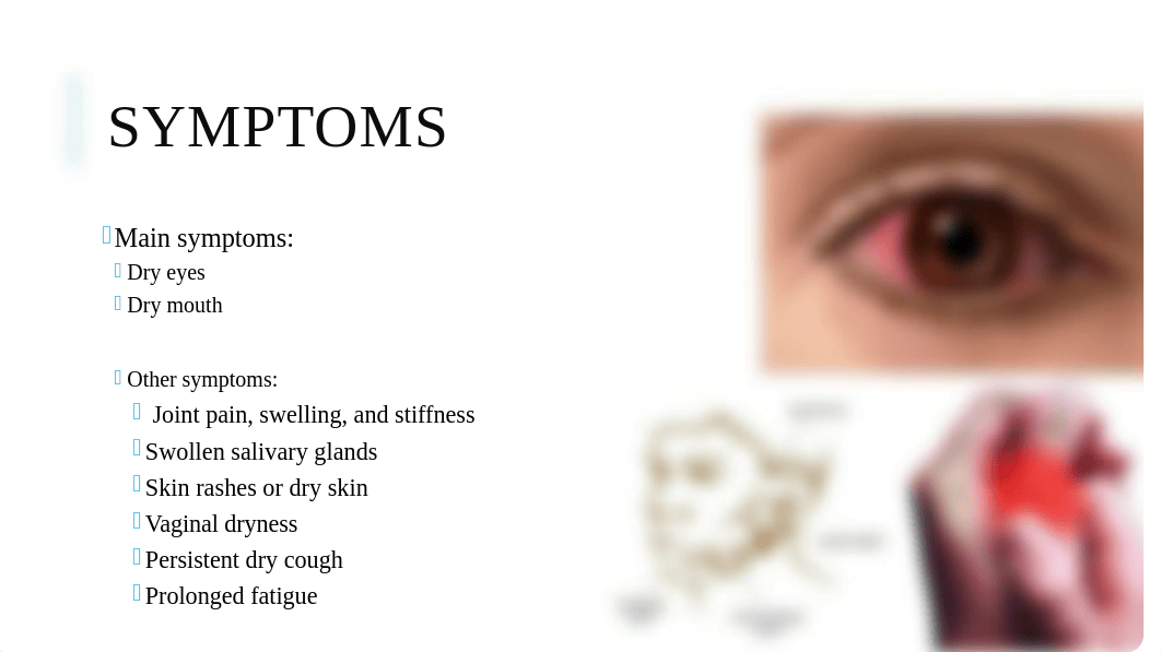 Sjogren's syndrome_dqc6wav8rxb_page3