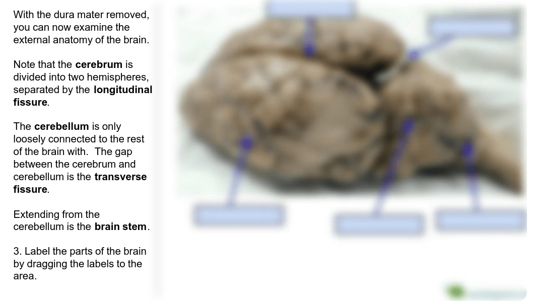 Sheep Brain Dissection lab (Online).pdf_dqfsa9om980_page5