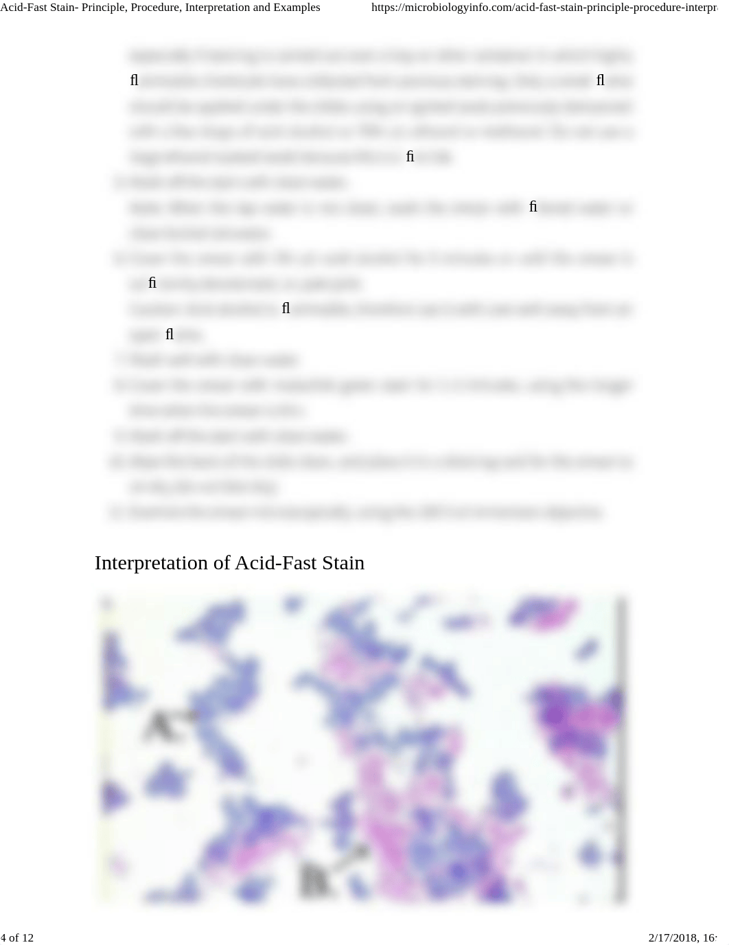 Acid-Fast Stain- Principle, Procedure, Interpretation and Examples.pdf_dqgs8euavx9_page4