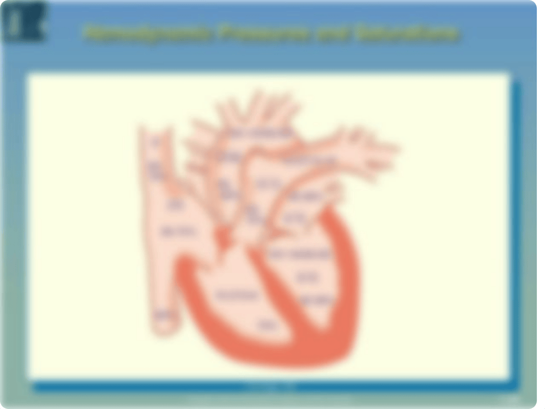 Hemodynamic Review.ppt_dqilqutcow2_page4