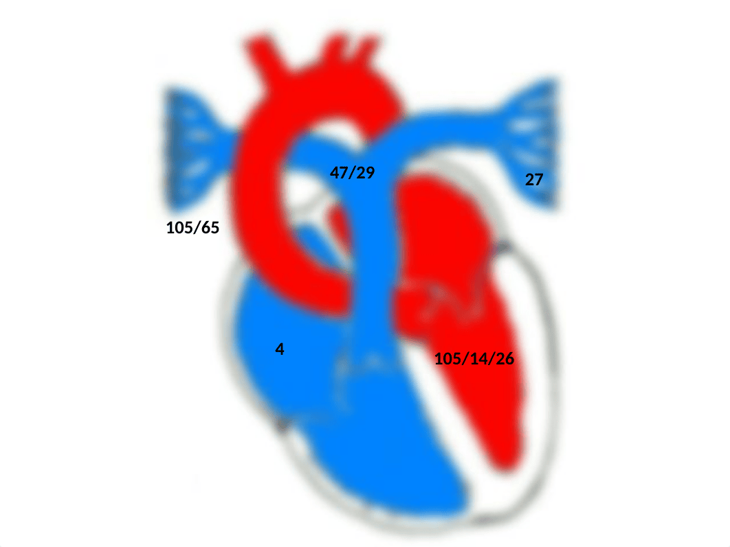 Hemodynamic Review.ppt_dqilqutcow2_page5