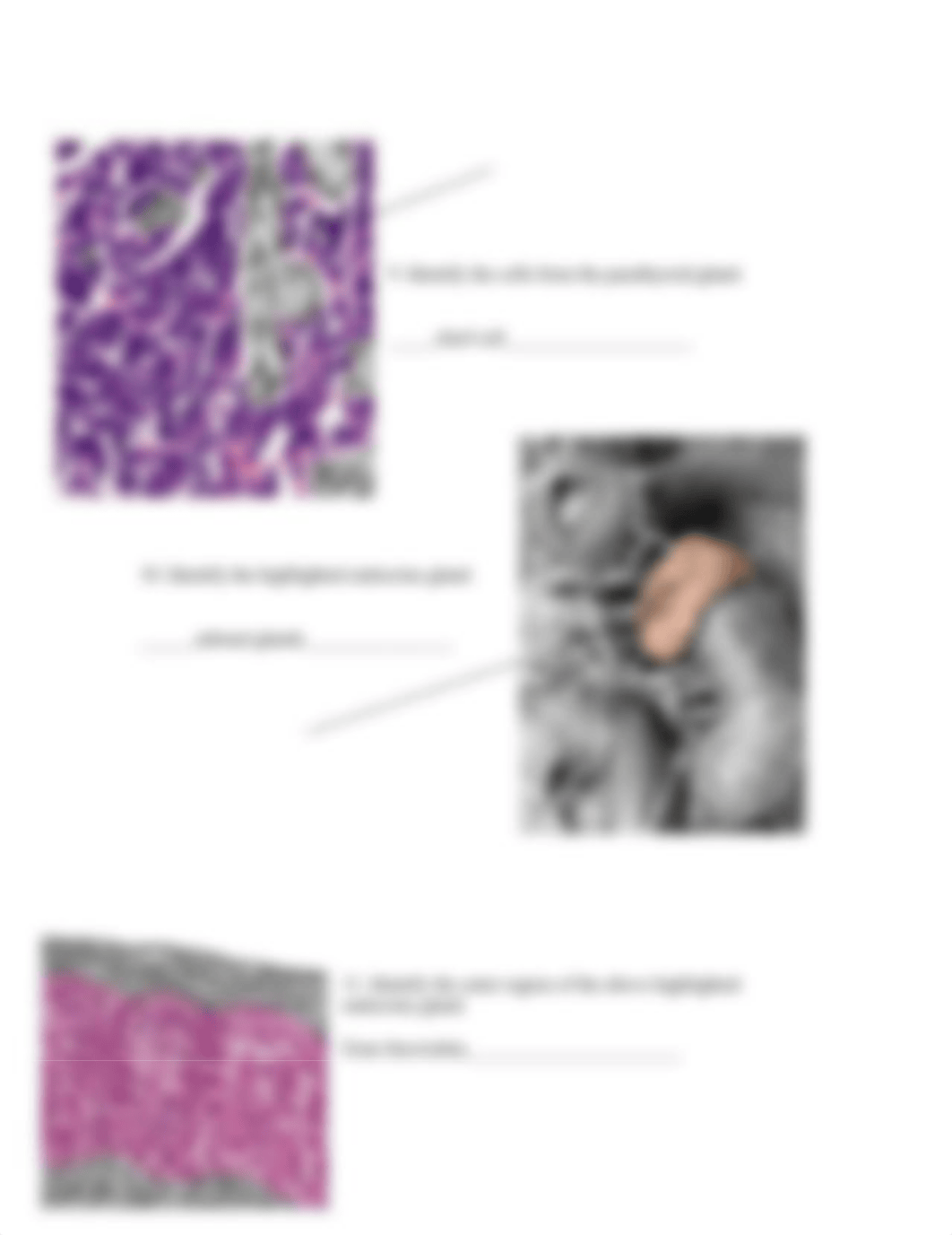 real anatomy endocrine anatomy (1).doc_dqokie70gis_page3