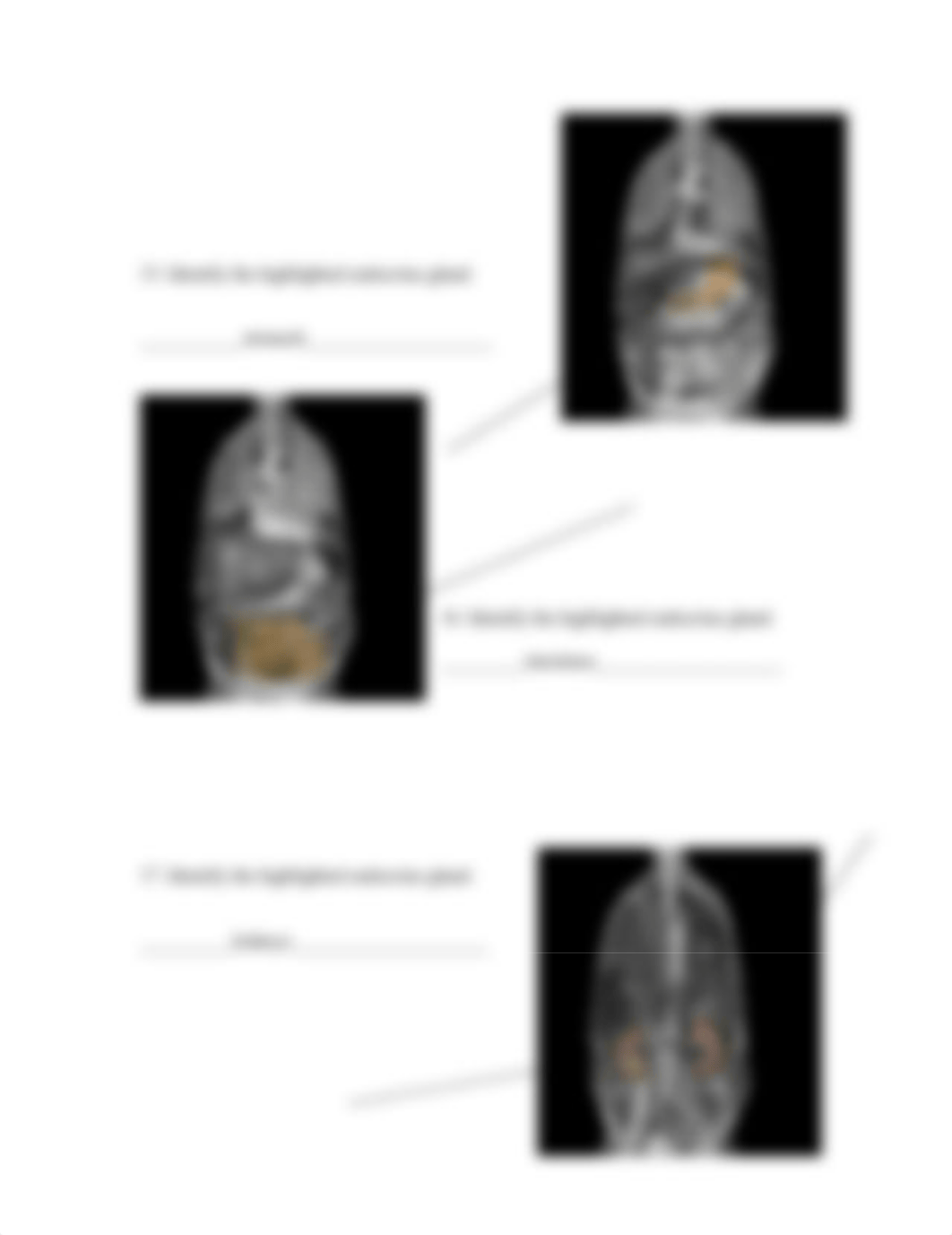 real anatomy endocrine anatomy (1).doc_dqokie70gis_page5