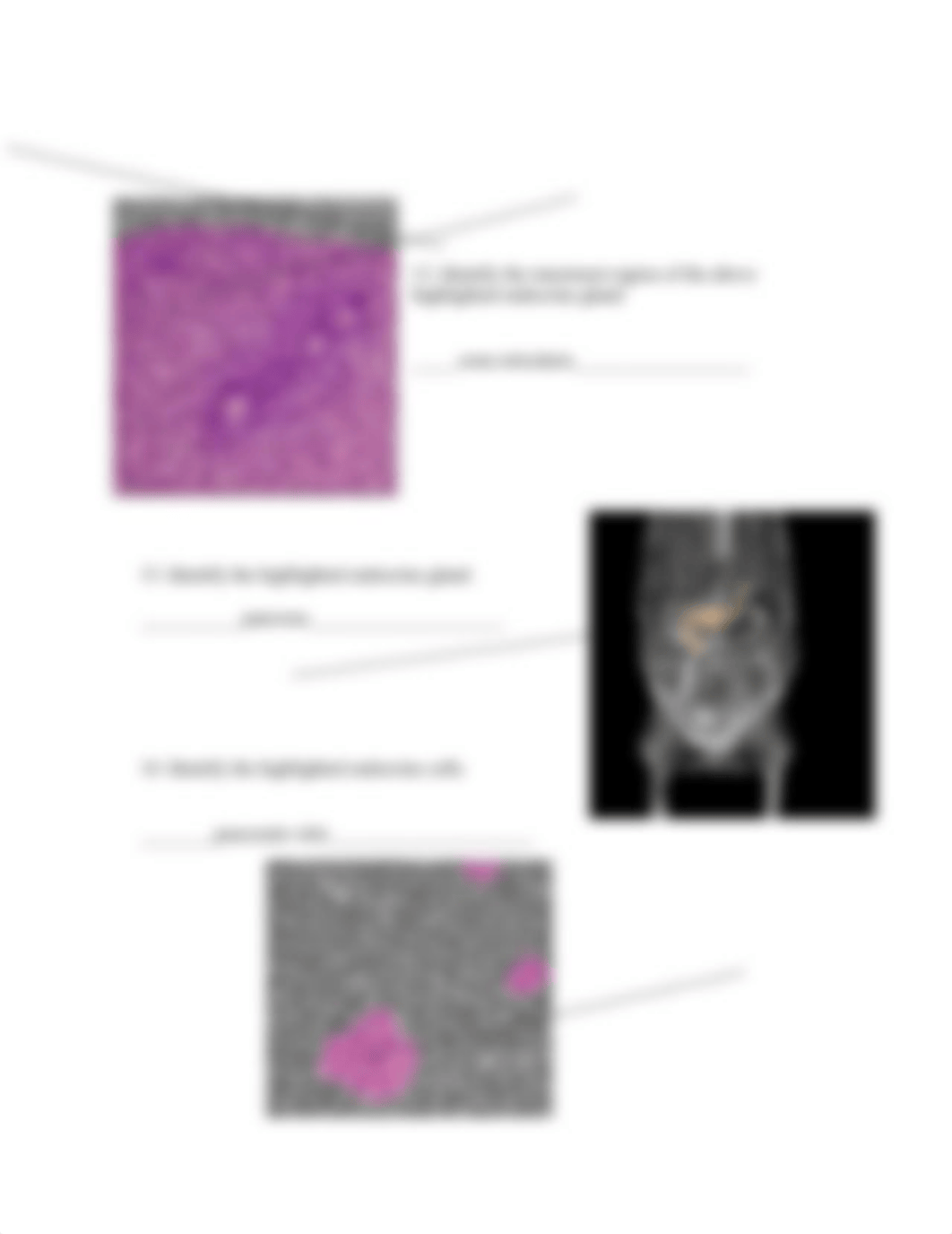 real anatomy endocrine anatomy (1).doc_dqokie70gis_page4