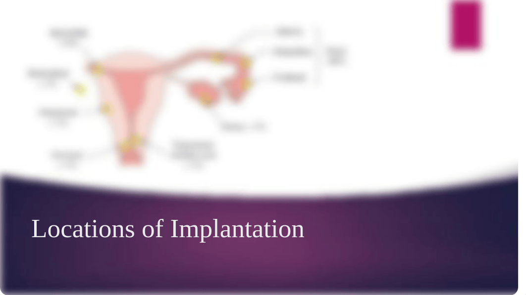 ectopic pregnancy.pptx_dqpfgyq5z8y_page3