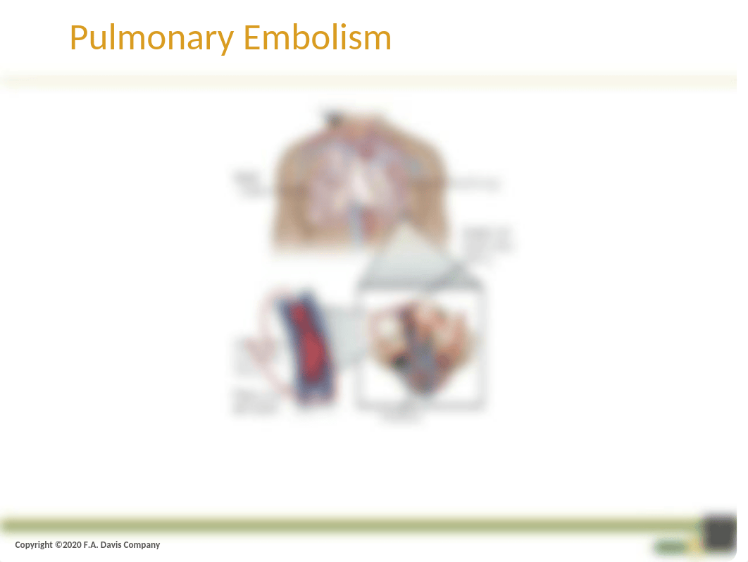 Pulmonary Embolism_Ch27.pptx_dqpghvzsq7g_page5