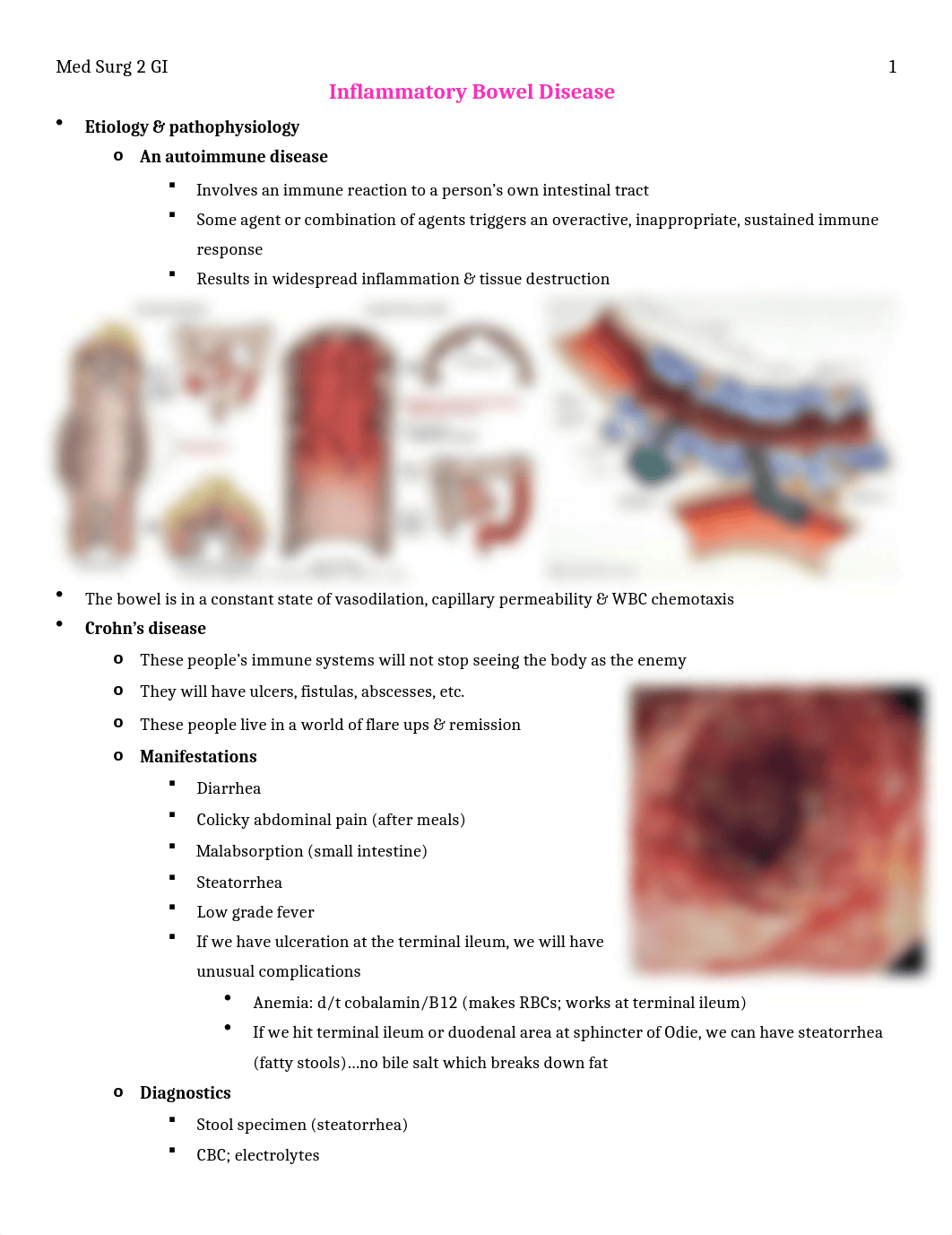 Med Surg 2 Exam 3 GI Study Guide .docx_dqyskszbdok_page1