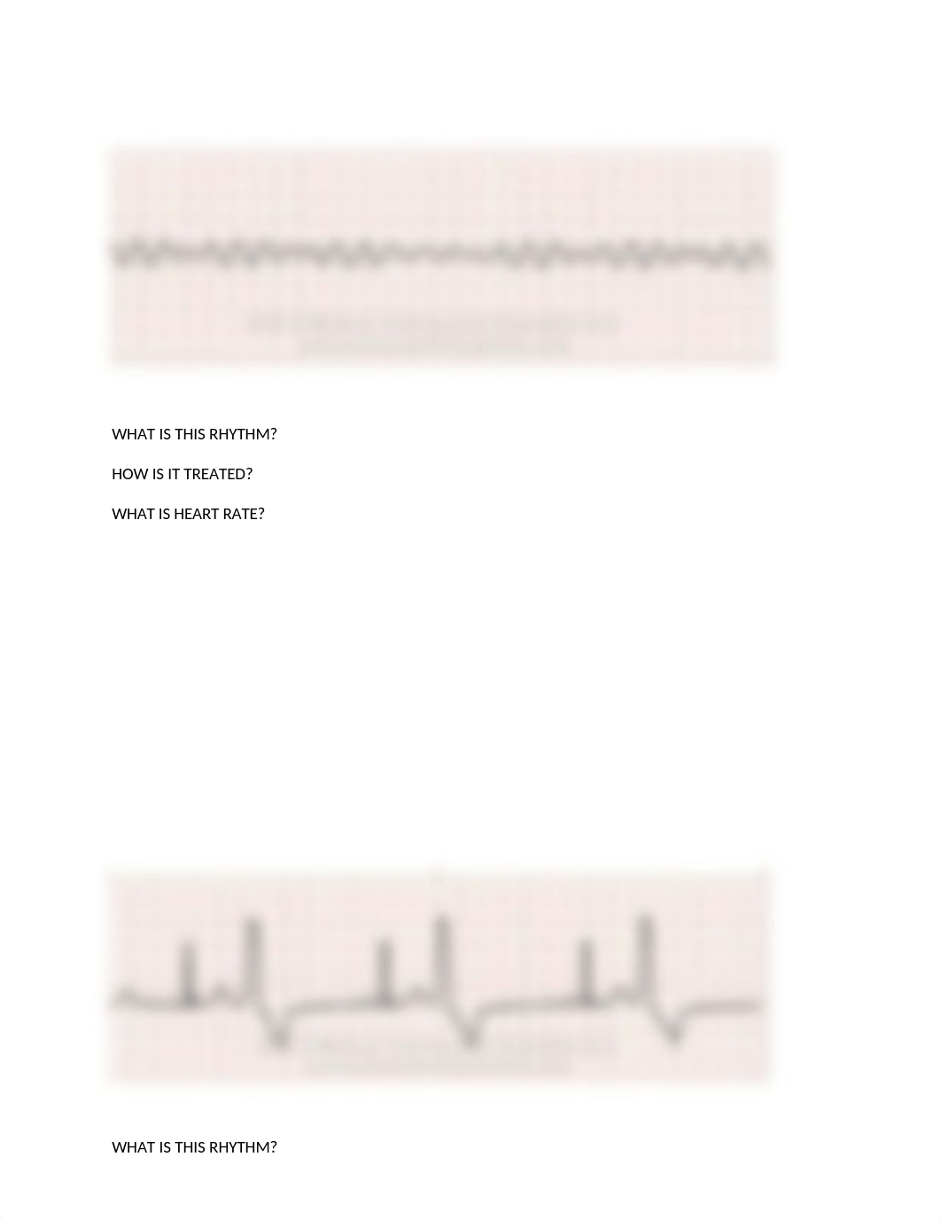 EKG INTERPRETATION PRACTICE(1) (1).docx_dqzd7yh2pj3_page2