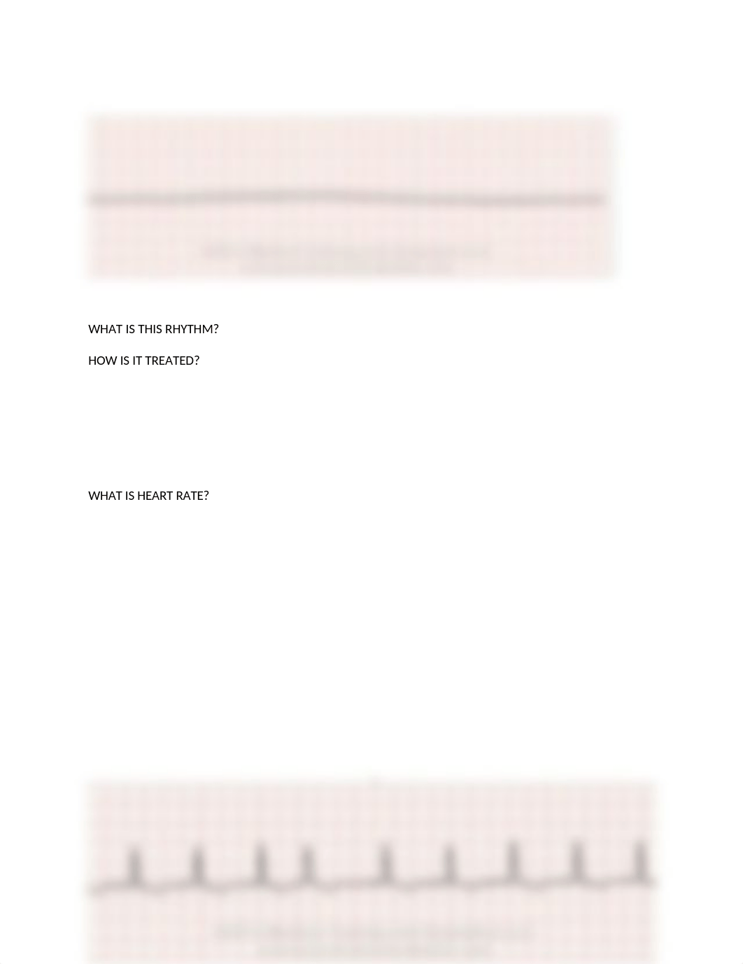 EKG INTERPRETATION PRACTICE(1) (1).docx_dqzd7yh2pj3_page3