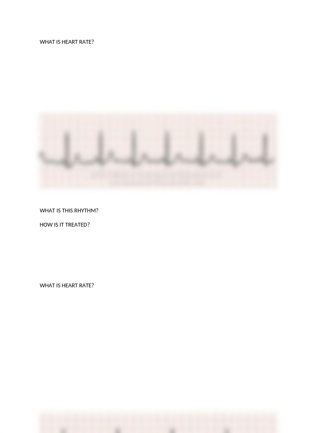 EKG INTERPRETATION PRACTICE(1) (1).docx_dqzd7yh2pj3_page4