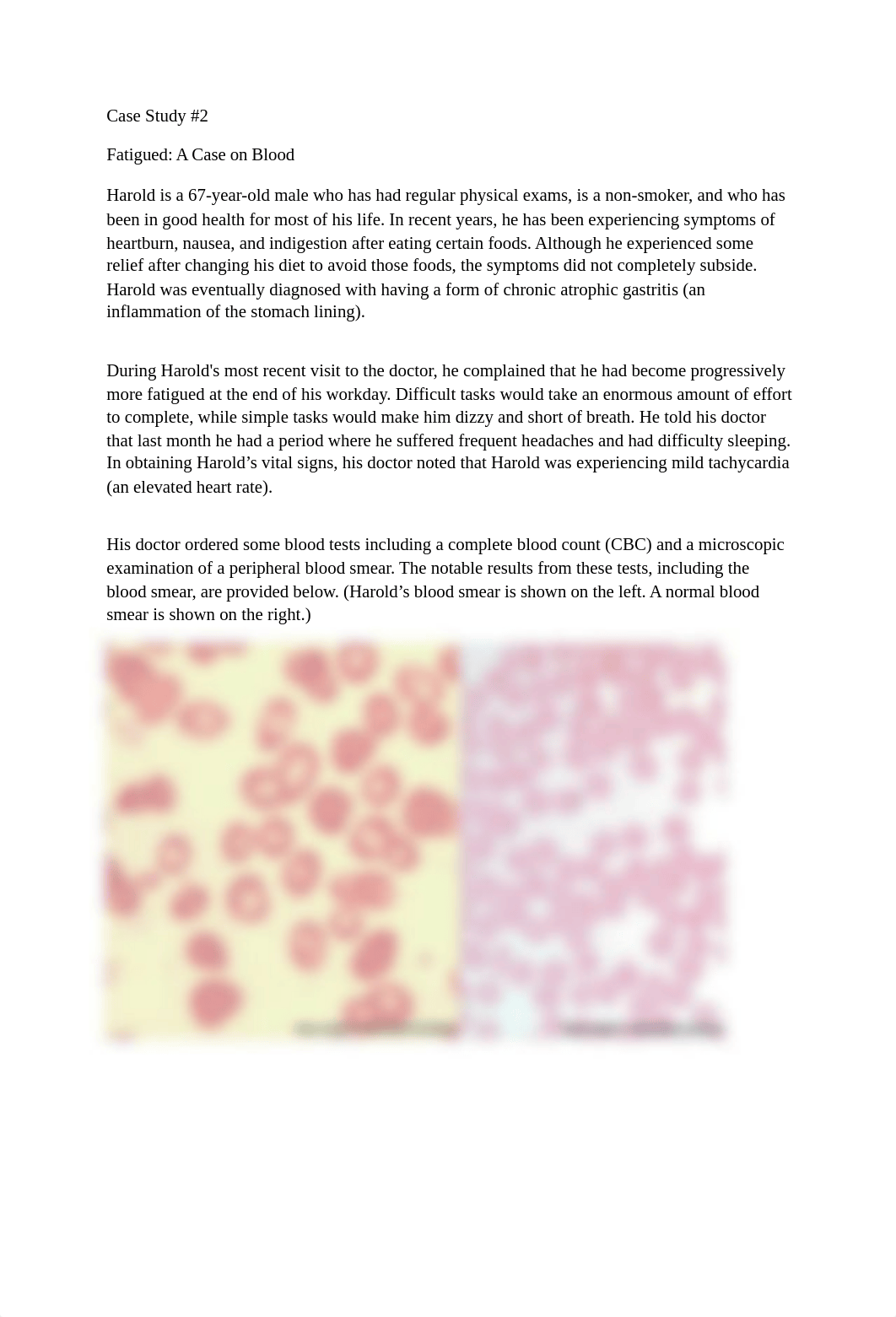 Case Study #2 - Fatiqued_ A Case on Blood.docx_dr2d165kms7_page1