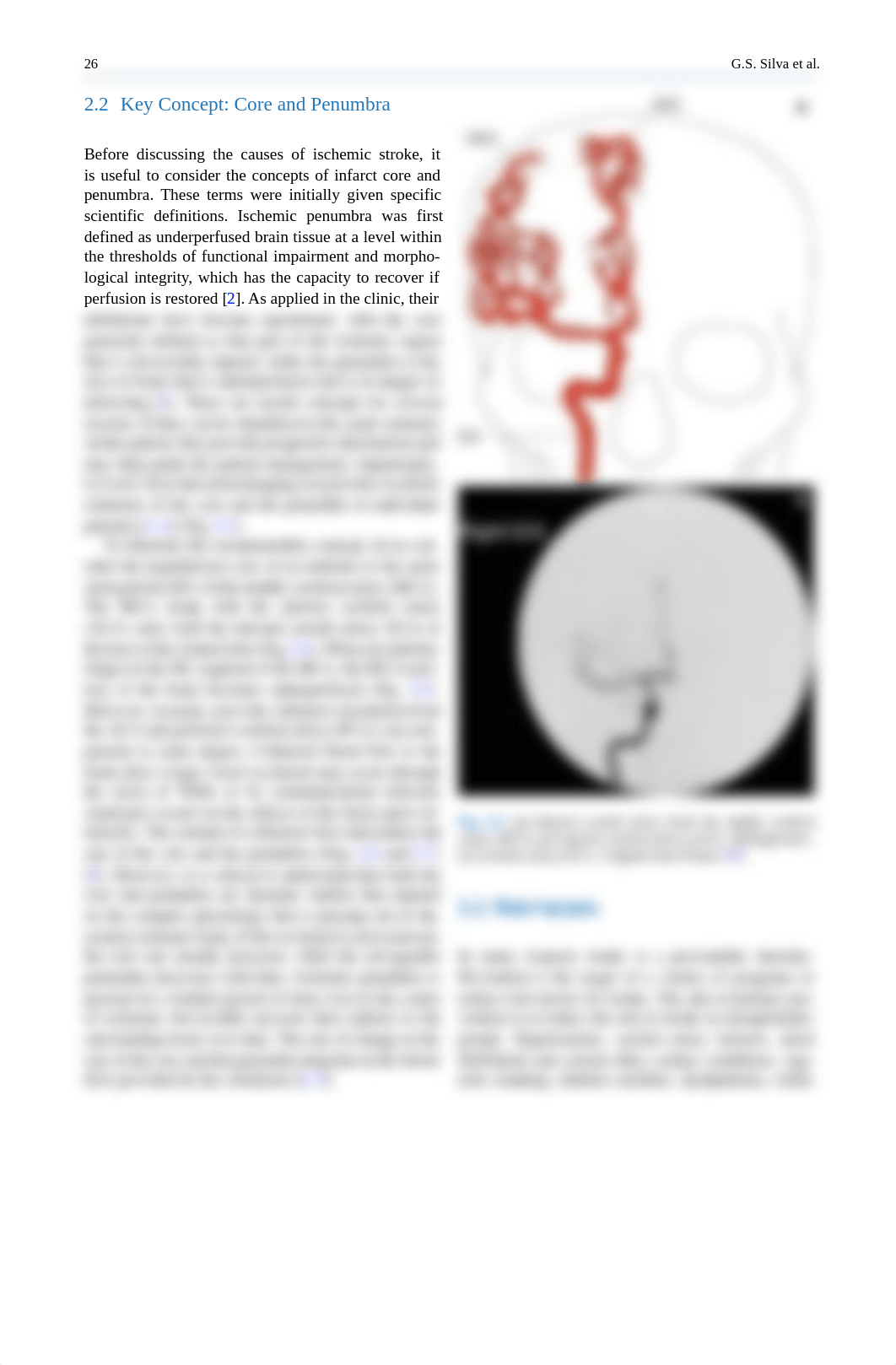 Causes_of_Ischemic_Stroke.pdf_dr36w8adwvf_page3