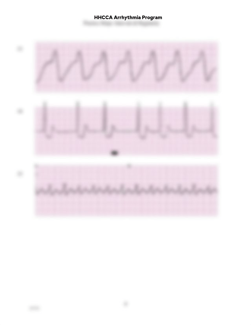 ECG-practice-rhythms.pdf_drb810t6xqh_page5