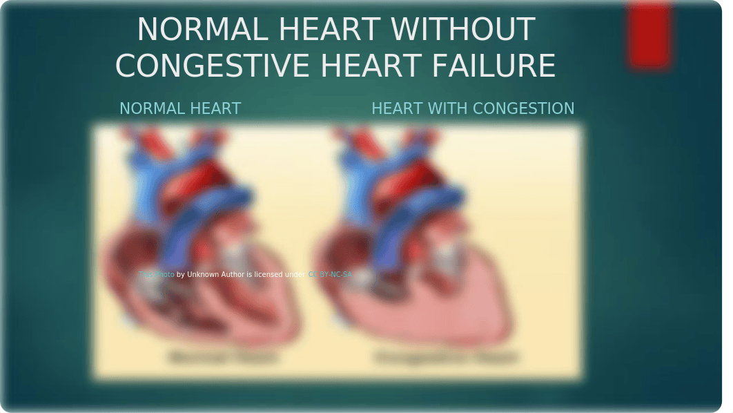 Congestive Heart Failure..Other Problems.pptx_drdbz0gwjac_page2