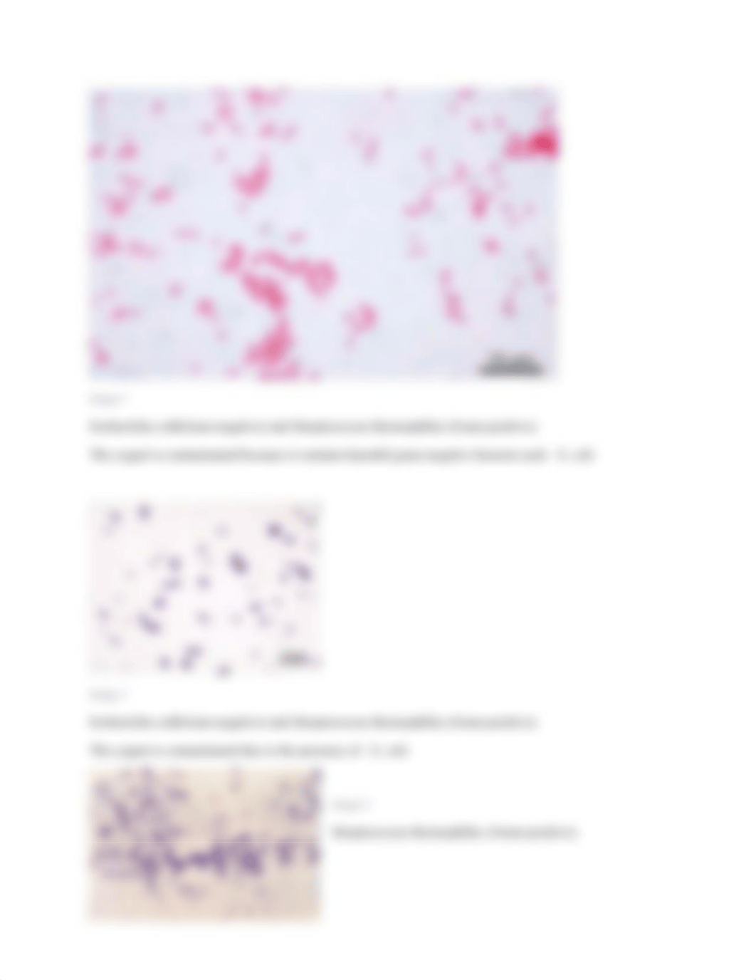 Lab #5 Simple n Differential Staining Quiz .docx_dreygslnwha_page2